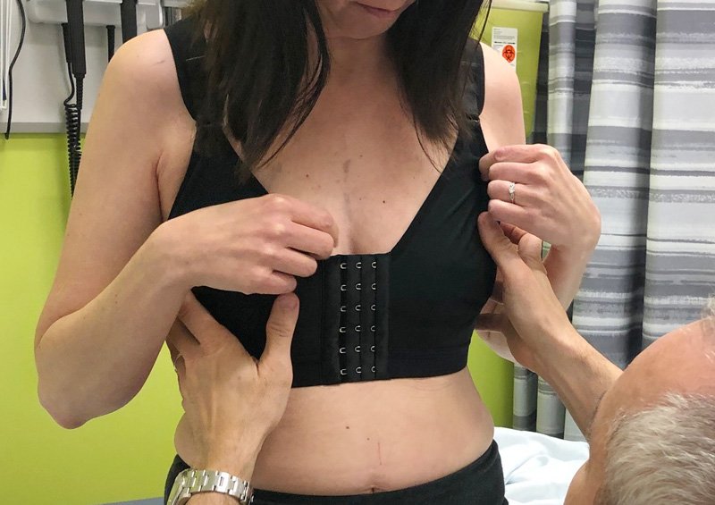 Post Explant - Bra Fitting